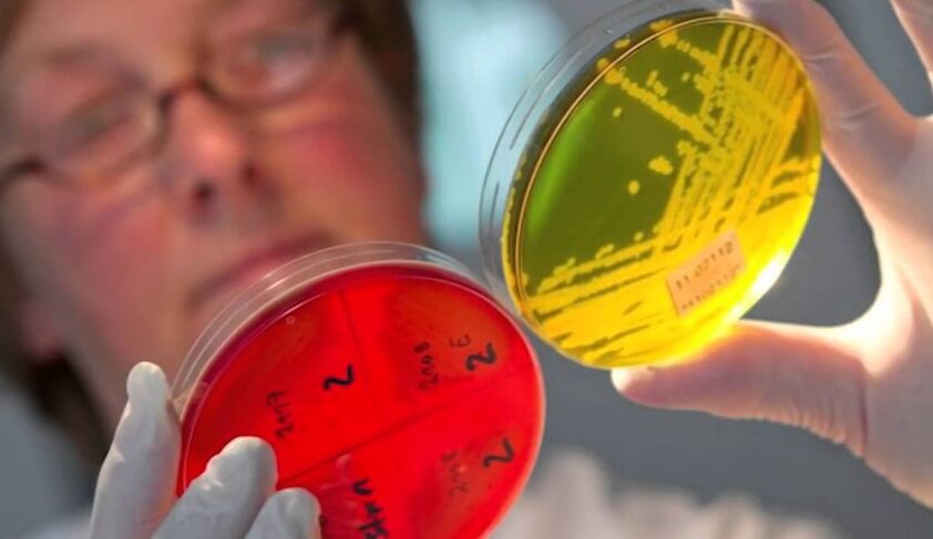 A paraziták diagnosztizálása az emberi testben
