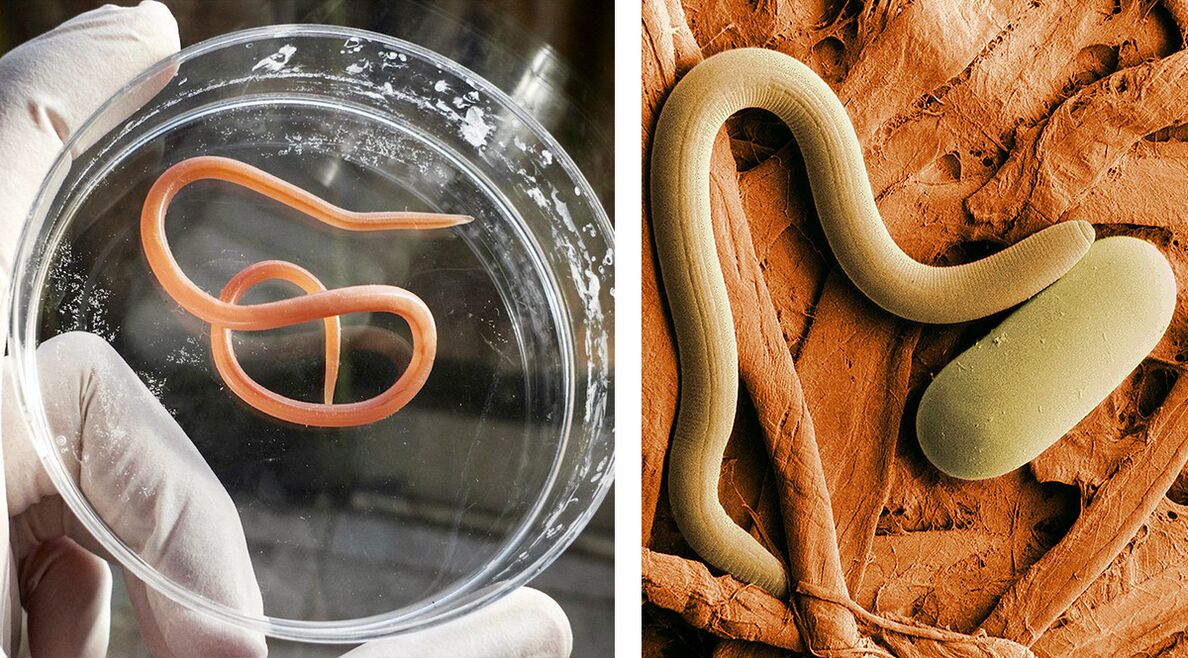 paraziták az emberi szervezetben